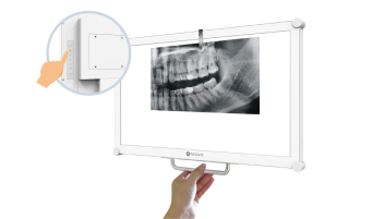 DR2202_Accessible X-Ray Film Viewing with Customisable Accessories_s