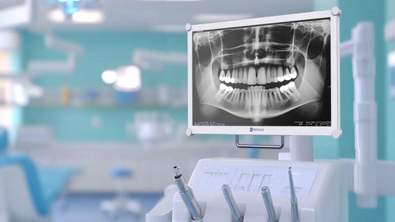 a x-ray of teeth on a display with optical bonding